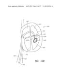 SYSTEMS AND METHODS FOR PERFORMING MINIMALLY INVASIVE PROCEDURES diagram and image