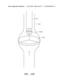 SYSTEMS AND METHODS FOR PERFORMING MINIMALLY INVASIVE PROCEDURES diagram and image