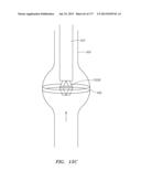 SYSTEMS AND METHODS FOR PERFORMING MINIMALLY INVASIVE PROCEDURES diagram and image