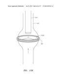 SYSTEMS AND METHODS FOR PERFORMING MINIMALLY INVASIVE PROCEDURES diagram and image