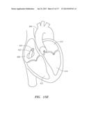 SYSTEMS AND METHODS FOR PERFORMING MINIMALLY INVASIVE PROCEDURES diagram and image