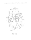 SYSTEMS AND METHODS FOR PERFORMING MINIMALLY INVASIVE PROCEDURES diagram and image