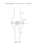 SYSTEMS AND METHODS FOR PERFORMING MINIMALLY INVASIVE PROCEDURES diagram and image