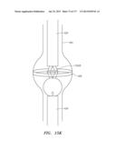 SYSTEMS AND METHODS FOR PERFORMING MINIMALLY INVASIVE PROCEDURES diagram and image