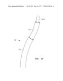 SYSTEMS AND METHODS FOR PERFORMING MINIMALLY INVASIVE PROCEDURES diagram and image