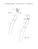 SYSTEMS AND METHODS FOR PERFORMING MINIMALLY INVASIVE PROCEDURES diagram and image