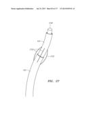 SYSTEMS AND METHODS FOR PERFORMING MINIMALLY INVASIVE PROCEDURES diagram and image