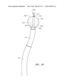 SYSTEMS AND METHODS FOR PERFORMING MINIMALLY INVASIVE PROCEDURES diagram and image