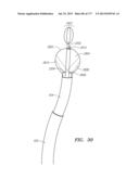 SYSTEMS AND METHODS FOR PERFORMING MINIMALLY INVASIVE PROCEDURES diagram and image