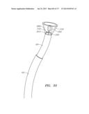 SYSTEMS AND METHODS FOR PERFORMING MINIMALLY INVASIVE PROCEDURES diagram and image