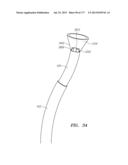 SYSTEMS AND METHODS FOR PERFORMING MINIMALLY INVASIVE PROCEDURES diagram and image