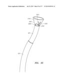 SYSTEMS AND METHODS FOR PERFORMING MINIMALLY INVASIVE PROCEDURES diagram and image