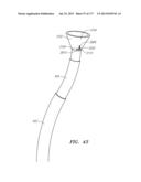 SYSTEMS AND METHODS FOR PERFORMING MINIMALLY INVASIVE PROCEDURES diagram and image