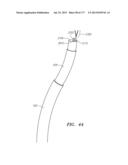 SYSTEMS AND METHODS FOR PERFORMING MINIMALLY INVASIVE PROCEDURES diagram and image