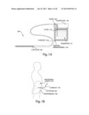 METHODS AND DEVICES FOR SELECTIVE DISRUPTION OF VISCERAL FAT BY CONTROLLED     COOLING diagram and image