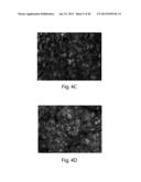 METHODS AND DEVICES FOR SELECTIVE DISRUPTION OF VISCERAL FAT BY CONTROLLED     COOLING diagram and image