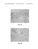 METHODS AND DEVICES FOR SELECTIVE DISRUPTION OF VISCERAL FAT BY CONTROLLED     COOLING diagram and image