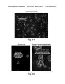 METHODS AND DEVICES FOR SELECTIVE DISRUPTION OF VISCERAL FAT BY CONTROLLED     COOLING diagram and image