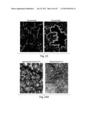 METHODS AND DEVICES FOR SELECTIVE DISRUPTION OF VISCERAL FAT BY CONTROLLED     COOLING diagram and image