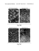 METHODS AND DEVICES FOR SELECTIVE DISRUPTION OF VISCERAL FAT BY CONTROLLED     COOLING diagram and image