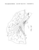 MOTORIZED SURGICAL CUTTING AND FASTENING INSTRUMENT HAVING HANDLE BASED     POWER SOURCE diagram and image