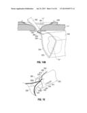 Reusable Surgical Retrieval Apparatus with Disposable Cartridge Assembly diagram and image