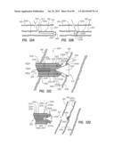 CLIP APPLIER AND METHODS OF USE diagram and image