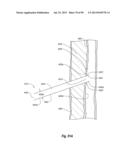 CLIP APPLIER AND METHODS OF USE diagram and image