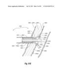 CLIP APPLIER AND METHODS OF USE diagram and image