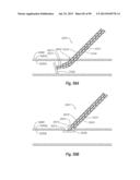 CLIP APPLIER AND METHODS OF USE diagram and image