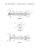 CLIP APPLIER AND METHODS OF USE diagram and image