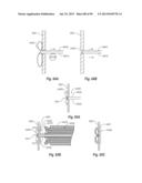 CLIP APPLIER AND METHODS OF USE diagram and image