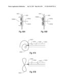 CLIP APPLIER AND METHODS OF USE diagram and image