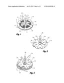 METHODS OF REPAIRING A HERNIA USING A HERNIA SUPPORT DEVICE diagram and image