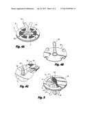 METHODS OF REPAIRING A HERNIA USING A HERNIA SUPPORT DEVICE diagram and image