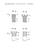 IMPLANTABLE FLOW CONNECTOR diagram and image