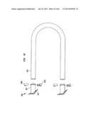 IMPLANTABLE FLOW CONNECTOR diagram and image