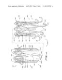 IMPLANTABLE FLOW CONNECTOR diagram and image