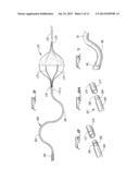 ROTATIONAL THROMBECTOMY WIRE WITH BLOCKING DEVICE diagram and image