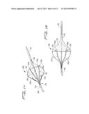 ROTATIONAL THROMBECTOMY WIRE WITH BLOCKING DEVICE diagram and image