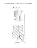 ROTATIONAL THROMBECTOMY WIRE WITH BLOCKING DEVICE diagram and image