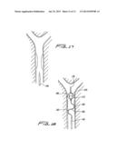 ROTATIONAL THROMBECTOMY WIRE WITH BLOCKING DEVICE diagram and image