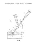 BIOADHESIVE DELIVERY CATHETER MANIFOLD WITH MIXING FIXTURE AND METHODS diagram and image