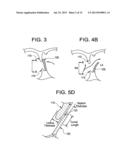 SINGLE DISC OCCLUSIONARY PATENT FORAMEN OVALE CLOSURE DEVICE diagram and image