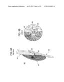 SINGLE DISC OCCLUSIONARY PATENT FORAMEN OVALE CLOSURE DEVICE diagram and image