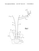 Apparatus For Coupling Soft Tissue To A Bone diagram and image