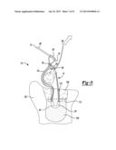 Apparatus For Coupling Soft Tissue To A Bone diagram and image