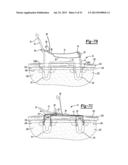 Apparatus For Coupling Soft Tissue To A Bone diagram and image