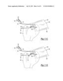 Apparatus For Coupling Soft Tissue To A Bone diagram and image