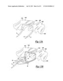 Apparatus For Coupling Soft Tissue To A Bone diagram and image